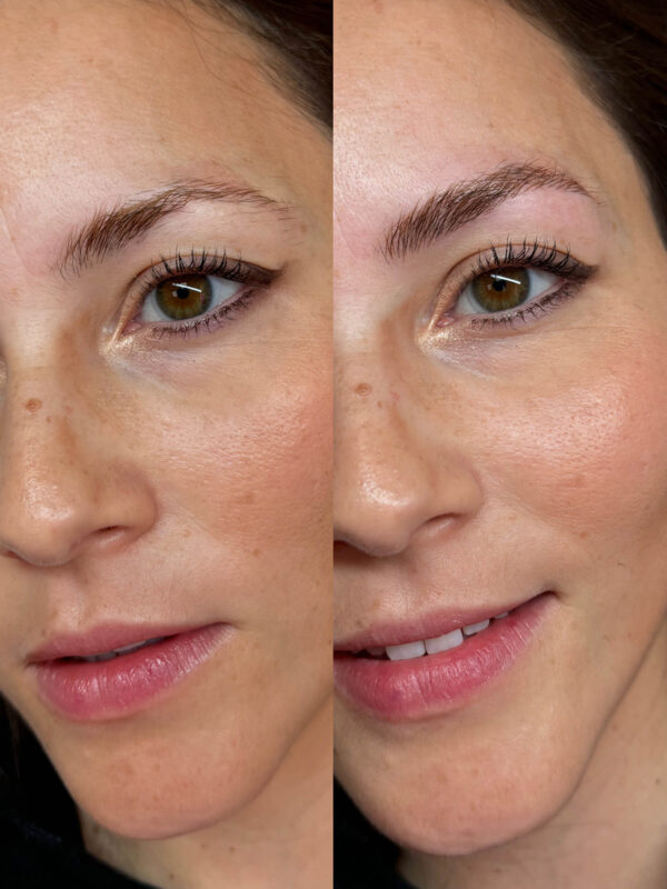 Microblading