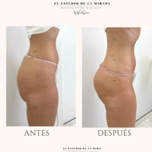 Método EDM