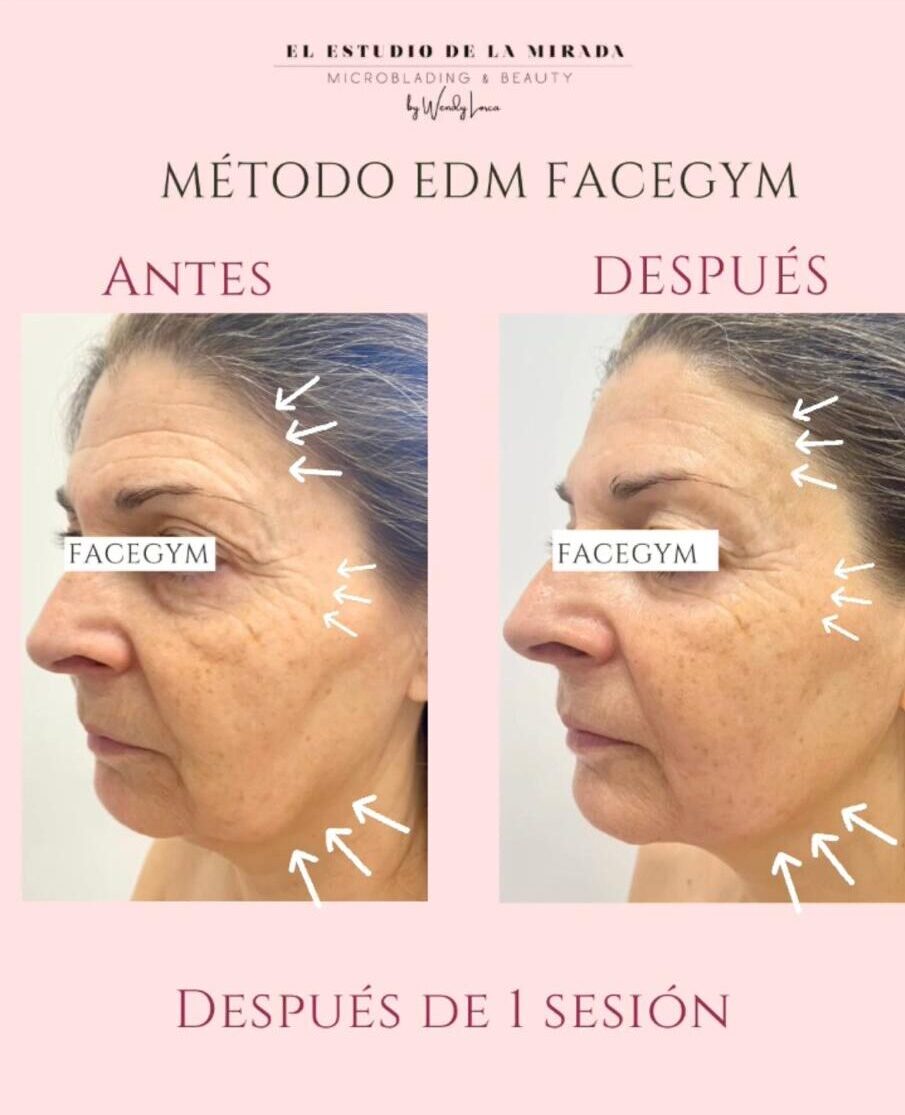 edm-4
