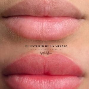 LABIOS