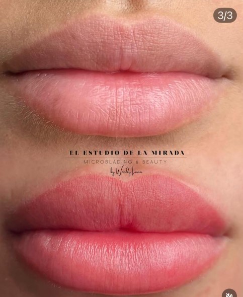 MICROPIGMENTACIÓN