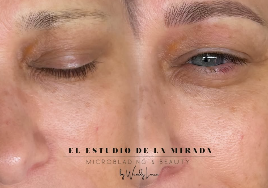 caso real- microblading